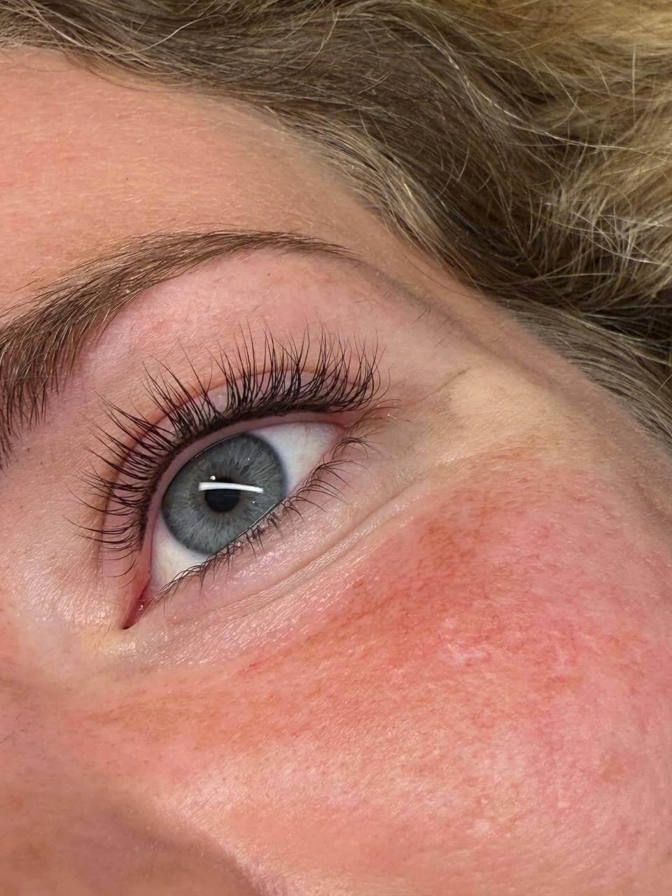 Infralash direct na de behandeling. Meppel