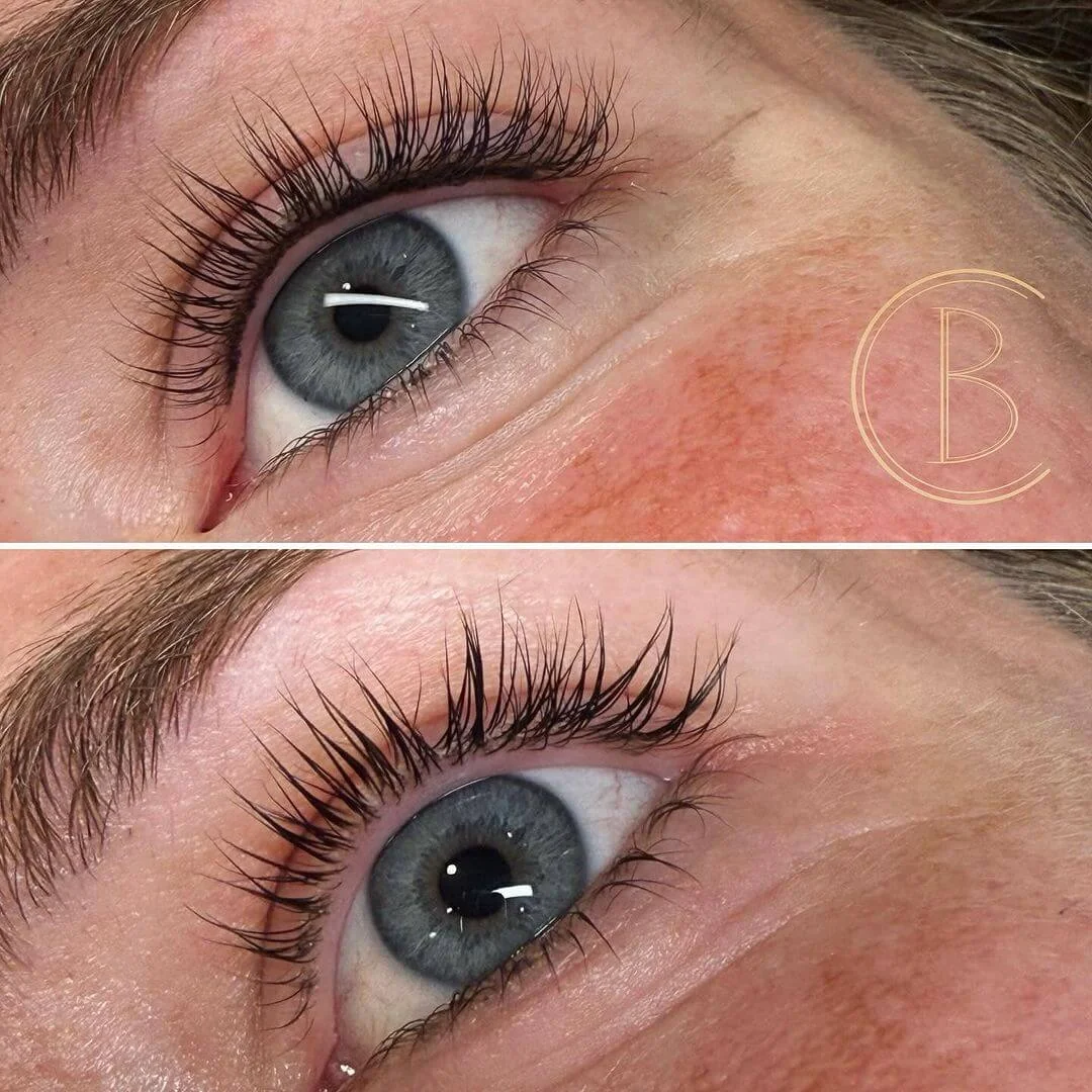 Voor en na Infralash behandeling